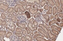 Hip Antibody (HL1969) - Azide and BSA Free, Novus Biologicals 100 &mu;L | Buy Online | Novus Biologicals | Fisher Scientific