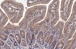 Hip Antibody (HL1969) - Azide and BSA Free, Novus Biologicals 100 &mu;L | Buy Online | Novus Biologicals | Fisher Scientific