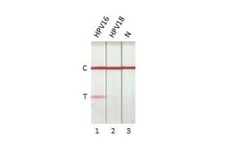 HPV16 E7 Antibody (HL1647) - Azide and BSA Free, Novus Biologicals 100