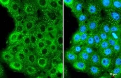 HPV16 E7 Antibody (HL1647) - Azide and BSA Free, Novus Biologicals 100