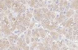KPNA3 Antibody (HL1573) - Azide and BSA Free, Novus Biologicals 100 &mu;L | Buy Online | Novus Biologicals | Fisher Scientific