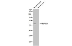 KPNA3 Antibody (HL1573) - Azide and BSA Free, Novus Biologicals 100 &mu;L | Buy Online | Novus Biologicals | Fisher Scientific