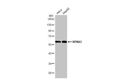 KPNA3 Antibody (HL1573) - Azide and BSA Free, Novus Biologicals 100 &mu;L | Buy Online | Novus Biologicals | Fisher Scientific