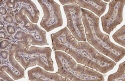 MAP3K8/Tpl2/COT Antibody (HL2118) - Azide and BSA Free, Novus Biologicals