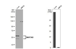 MAP3K8/Tpl2/COT Antibody (HL2118) - Azide and BSA Free, Novus Biologicals
