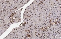 METTL14 Antibody (HL1816) - Azide and BSA Free, Novus Biologicals 100 &mu;L,