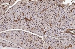 METTL14 Antibody (HL1816) - Azide and BSA Free, Novus Biologicals 100 &mu;L,