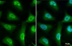 Nurr1/NGFI-B beta/NR4A2 Antibody (HL1852) - Azide and BSA Free, Novus Biologicals