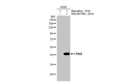 SerpinB2 Antibody (HL2218) - Azide and BSA Free, Novus Biologicals 100