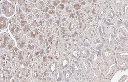 SerpinB2 Antibody (HL2218) - Azide and BSA Free, Novus Biologicals 100