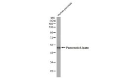 Pancreatic Lipase Antibody (HL1310) - Azide and BSA Free, Novus Biologicals
