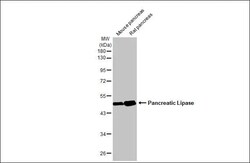 Pancreatic Lipase Antibody (HL1310) - Azide and BSA Free, Novus Biologicals