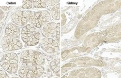 PARP14 Antibody (HL1178) - Azide and BSA Free, Novus Biologicals 100 &mu;L,