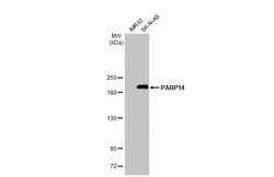PARP14 Antibody (HL1178) - Azide and BSA Free, Novus Biologicals 100 &mu;L,