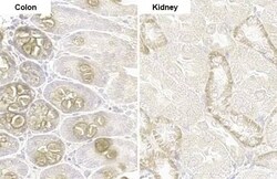 PARP14 Antibody (HL1178) - Azide and BSA Free, Novus Biologicals 100 &mu;L,