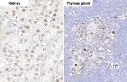 PARP3 Antibody (HL1509) - Azide and BSA Free, Novus Biologicals 100 &mu;L,