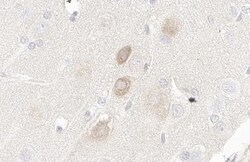 PIK3C2A Antibody (HL1612) - Azide and BSA Free, Novus Biologicals 100 &mu;L | Buy Online | Novus Biologicals | Fisher Scientific