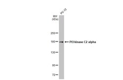 PIK3C2A Antibody (HL1612) - Azide and BSA Free, Novus Biologicals 100 &mu;L | Buy Online | Novus Biologicals | Fisher Scientific