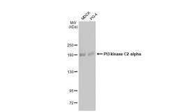 PIK3C2A Antibody (HL1612) - Azide and BSA Free, Novus Biologicals 100 &mu;L | Buy Online | Novus Biologicals | Fisher Scientific
