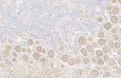 pan PKC, p Thr410 Antibody (HL1279) - Azide and BSA Free, Novus Biologicals