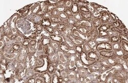 Transthyretin/Prealbumin Antibody (HL1823) - Azide and BSA Free, Novus