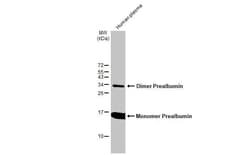 Transthyretin/Prealbumin Antibody (HL1823) - Azide and BSA Free, Novus