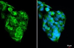 Transthyretin/Prealbumin Antibody (HL1823) - Azide and BSA Free, Novus