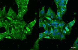 Transthyretin/Prealbumin Antibody (HL1823) - Azide and BSA Free, Novus