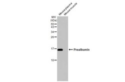 Transthyretin/Prealbumin Antibody (HL1823) - Azide and BSA Free, Novus