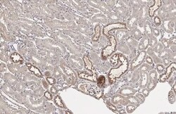 Transthyretin/Prealbumin Antibody (HL1823) - Azide and BSA Free, Novus