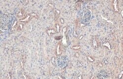 Rab5a Antibody (HL1497) - Azide and BSA Free, Novus Biologicals 100 &mu;L | Buy Online | Novus Biologicals | Fisher Scientific