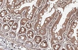 RGS4 Antibody (HL1522) - Azide and BSA Free, Novus Biologicals 100 &mu;L | Buy Online | Novus Biologicals | Fisher Scientific
