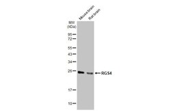 RGS4 Antibody (HL1522) - Azide and BSA Free, Novus Biologicals 100 &mu;L | Buy Online | Novus Biologicals | Fisher Scientific