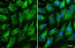 RIPK1/RIP1 Antibody (HL2250) - Azide and BSA Free, Novus Biologicals 100 &mu;L | Buy Online | Novus Biologicals | Fisher Scientific