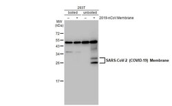 SARS-CoV-2 Membrane Protein Antibody (HL1088) - Azide and BSA Free, Novus