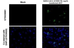 SARS-CoV-2 nsp12 Antibody (HL1415) - Azide and BSA Free, Novus Biologicals 100 &mu;L | Buy Online | Novus Biologicals | Fisher Scientific