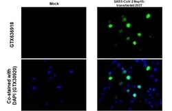 SARS-CoV-2 nsp15 Antibody (HL1446) - Azide and BSA Free, Novus Biologicals 100 &mu;L | Buy Online | Novus Biologicals | Fisher Scientific