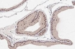 MKK4/MEK4 Antibody (HL1839) - Azide and BSA Free, Novus Biologicals 100