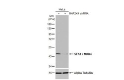 MKK4/MEK4 Antibody (HL1888) - Azide and BSA Free, Novus Biologicals 100