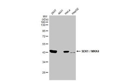 MKK4/MEK4 Antibody (HL1888) - Azide and BSA Free, Novus Biologicals 100