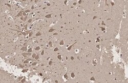 SERCA2 ATPase Antibody (HL2352) - Azide and BSA Free, Novus Biologicals