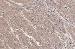 SERCA2 ATPase Antibody (HL2352) - Azide and BSA Free, Novus Biologicals