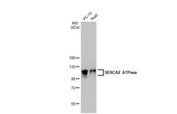 SERCA2 ATPase Antibody (HL2352) - Azide and BSA Free, Novus Biologicals
