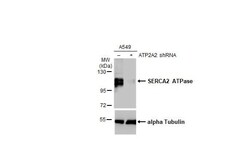 SERCA2 ATPase Antibody (HL2352) - Azide and BSA Free, Novus Biologicals