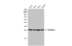 Sigma-1 R/OPRS1 Antibody (HL2230) - Azide and BSA Free, Novus Biologicals
