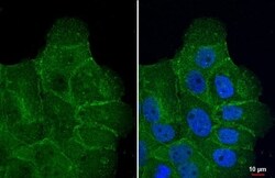 SLC1A5 Antibody (HL1617) - Azide and BSA Free, Novus Biologicals 100 &mu;L,