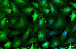 SLC1A5 Antibody (HL1988) - Azide and BSA Free, Novus Biologicals 100 &mu;L,