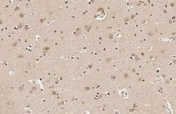 SOD1/Cu-Zn SOD Antibody (HL1652) - Azide and BSA Free, Novus Biologicals