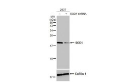 SOD1/Cu-Zn SOD Antibody (HL1652) - Azide and BSA Free, Novus Biologicals
