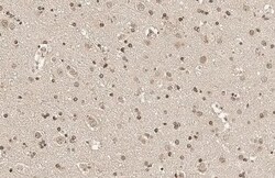 SOD1/Cu-Zn SOD Antibody (HL1652) - Azide and BSA Free, Novus Biologicals